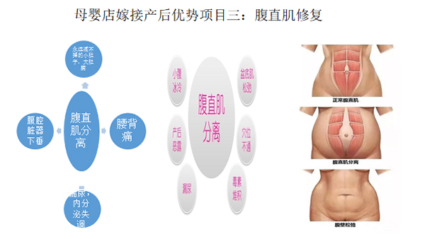 少林永化堂產(chǎn)后項(xiàng)目-腹直肌修復(fù).jpg 少林永化堂產(chǎn)后項(xiàng)目-腹直肌修復(fù).jpg