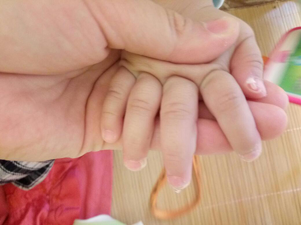 ÓƤôkԇԇ߼ɽo˪ѽ