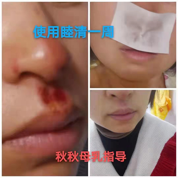 澏NÆ᣿M߿ڱa(chn)ƷȦ۟o(sh)